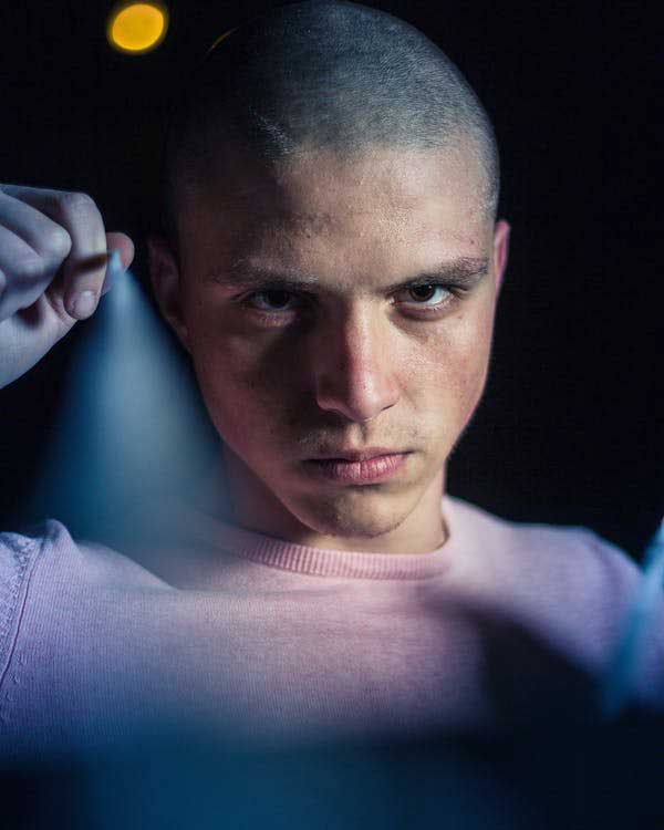 Baldness Man